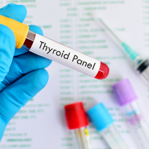 thyroid tests